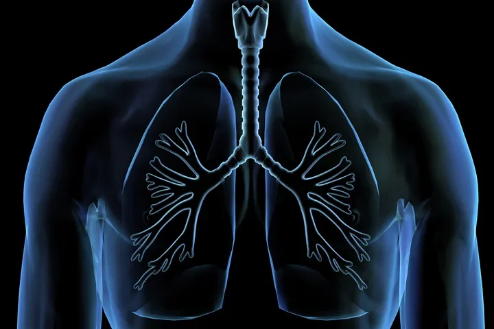 X-ray Lungs showing chest cavity with trachea and branching bronchi