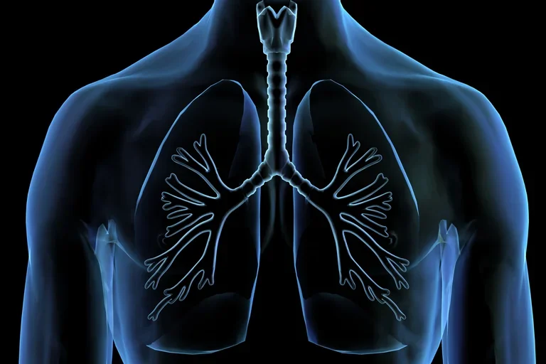 X-ray Lungs showing chest cavity with trachea and branching bronchi