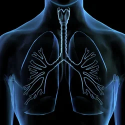 X-ray Lungs showing chest cavity with trachea and branching bronchi